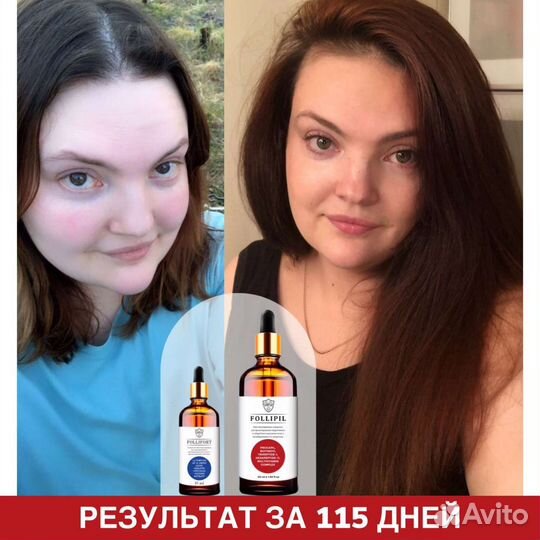 Сыворотка против выпадения волос