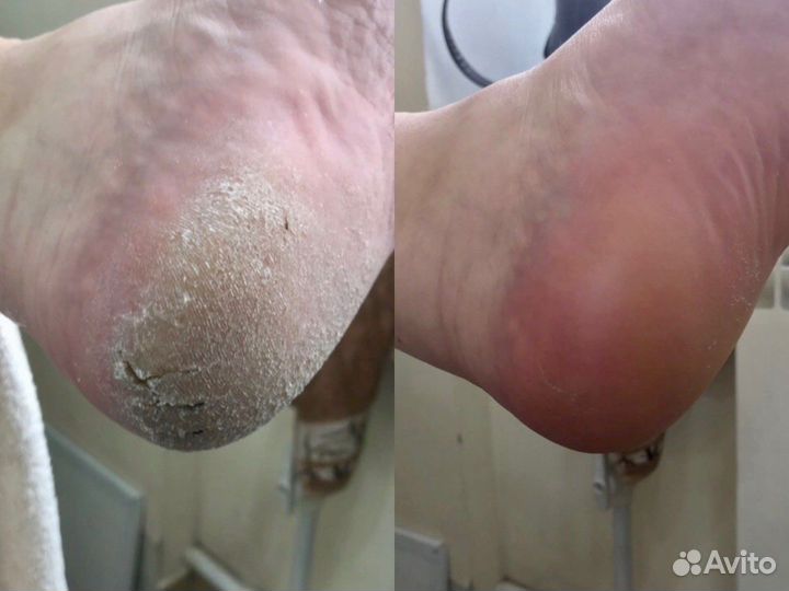 Педикюр и маникюр