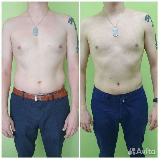 Коррекция фигуры на аппарате Slim beauty