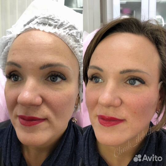 Косметолог Мурино