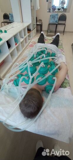 Аппаратный вакуумный баночный массаж