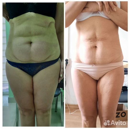 Массаж детям и взрослым / липопластика