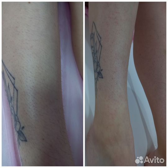 Шугаринг/ваксинг