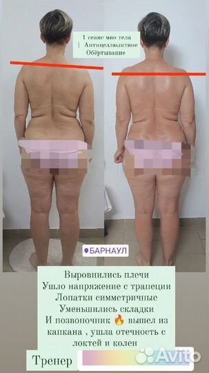 Миофасциальный массаж