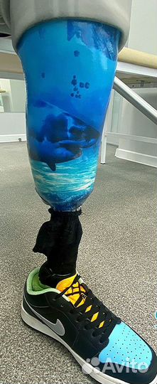 Протез ноги