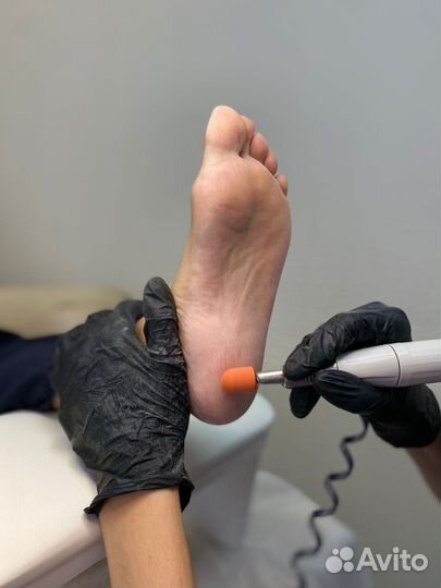 Аппаратный педикюр