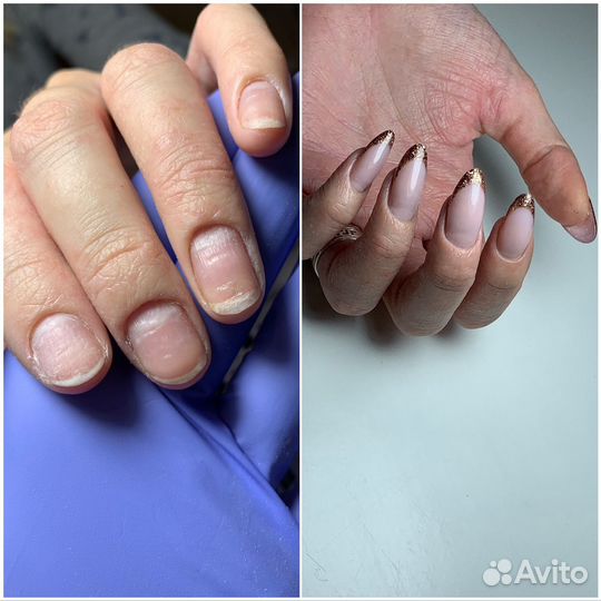 Маникюр/Педикюр наращивание ногтей