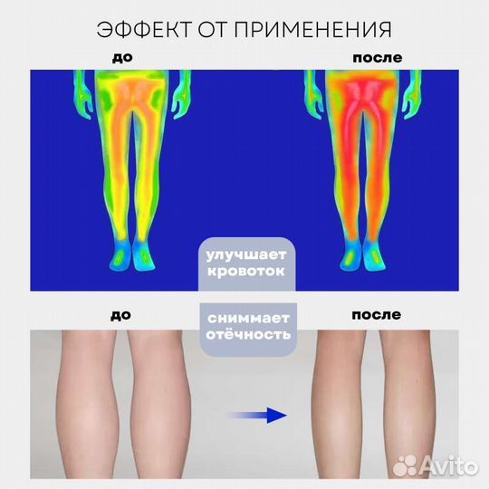 Компрессионный массажер для ног MFC 60