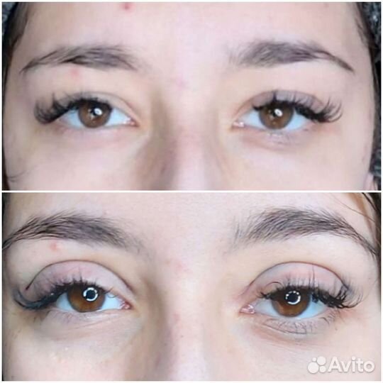 Сангапури - коррекция верхнего века