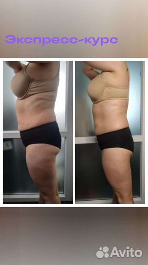 Вакуумный массаж