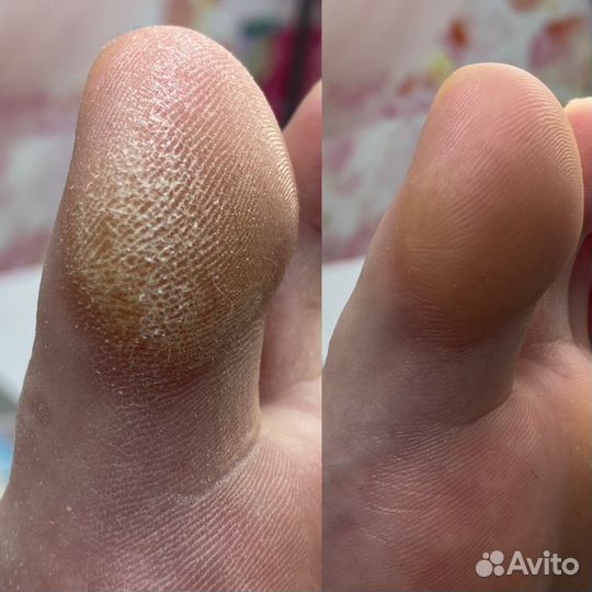 Мастер маникюра и педикюра