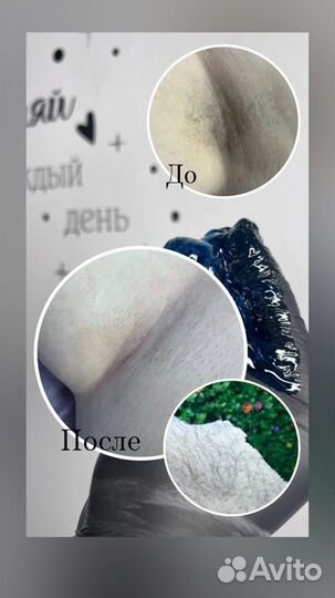 Депиляция/ шугаринг