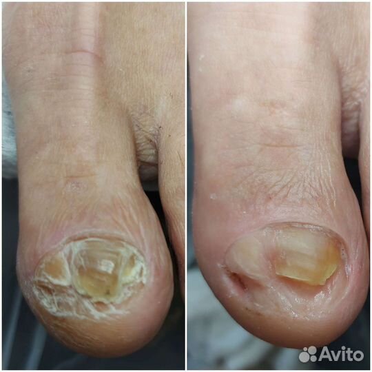 Подология, маникюр, шугаринг