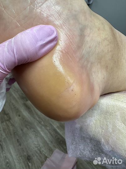 Модель на педикюр