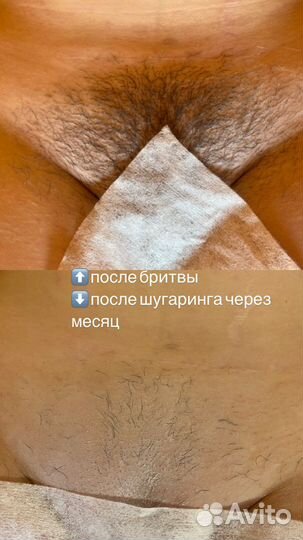 Шугаринг в Колпино