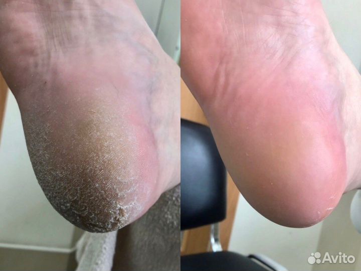 Педикюр и маникюр