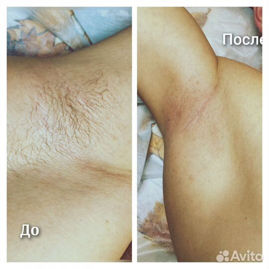 Шугаринг ЖК Цветы сахар/ воск, гл чистка бикини