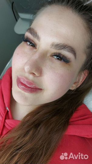 Увеличение губ,косметолог, ботокс