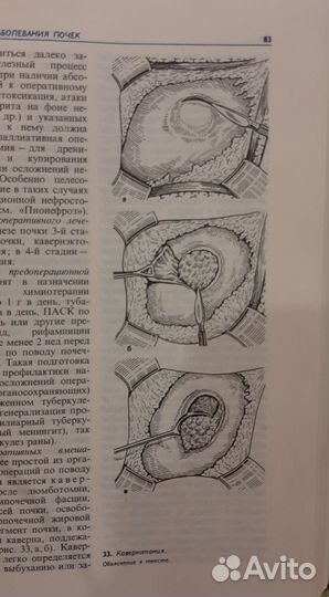 Оперативная урология руководство для врачей