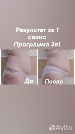 Аппаратная коррекция фигуры, общий вибромассаж