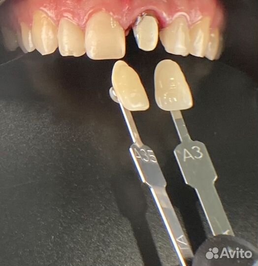 Система мобильной дентальной фотографии