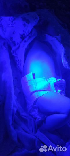 Аппарат синяя лампа невотон