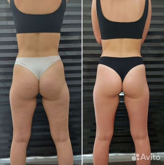 Массаж коррекция фигуры