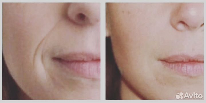 Косметолог эстетист резюме