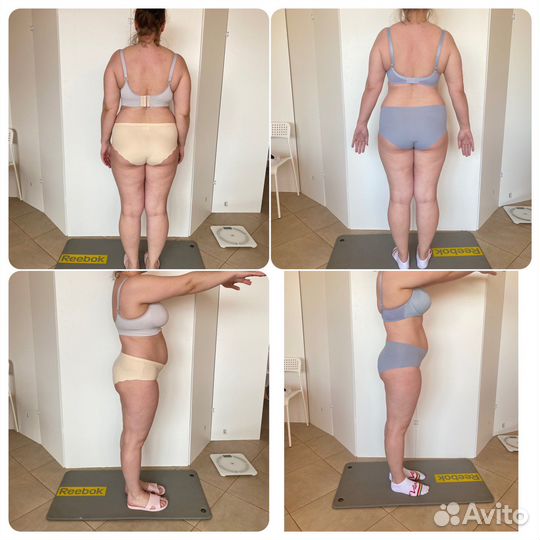 Аппаратный массаж