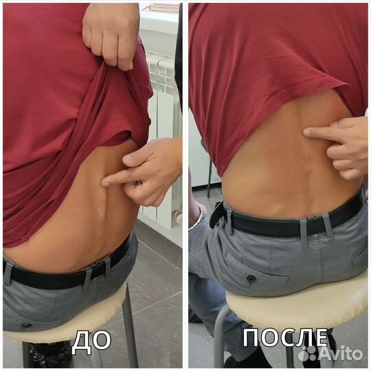 Акупрессура подзатылочных мышц