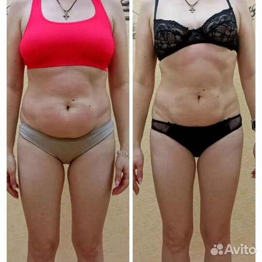 Антицеллюлитный, фитобочка, аппаратный