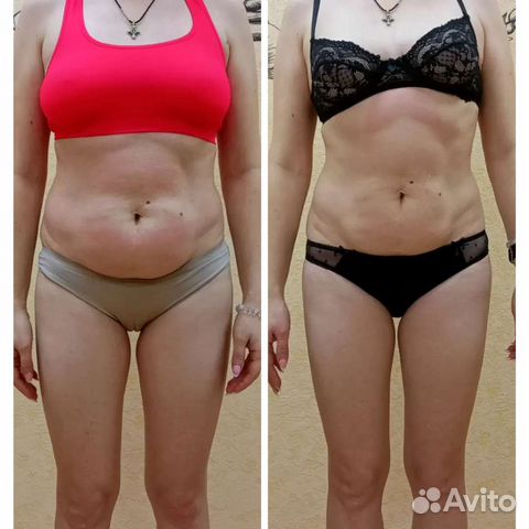 Антицеллюлитный, фитобочка, аппаратный