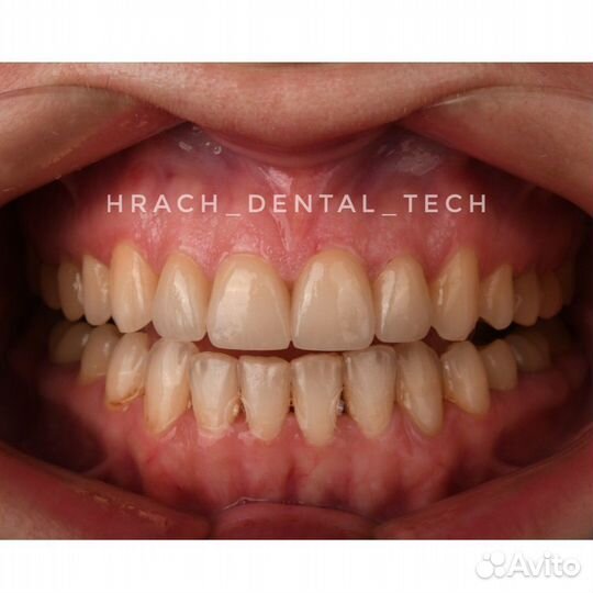 Зубной техник керамист сотрудничество с врачами