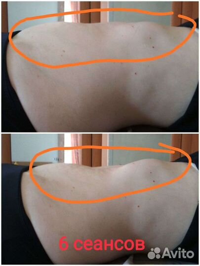 Массаж, спа, Детокс - уход