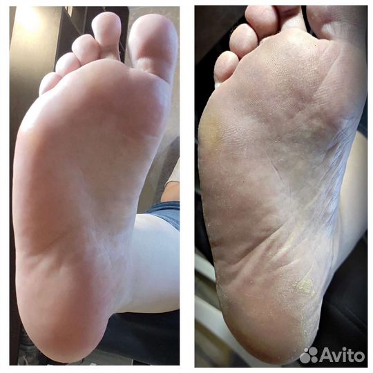 Маникюр педикюр на дому