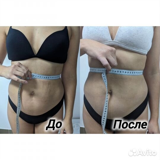 Антицеллюлитный массаж