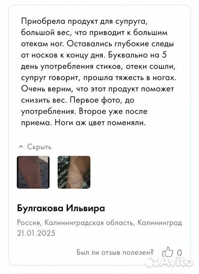 Убрать отеки навсегда