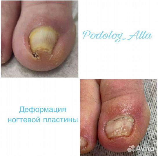 Подолог