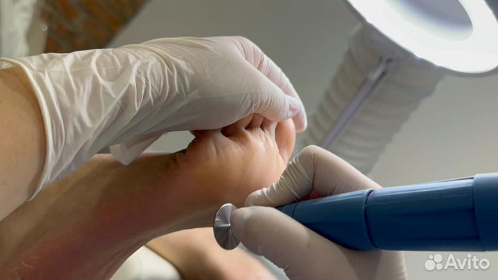 Смарт педикюр