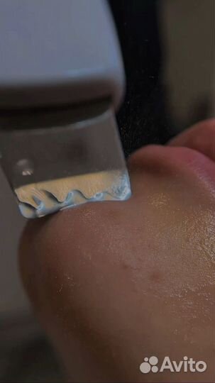 Косметология лица