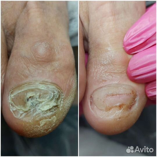 Подология, маникюр, шугаринг