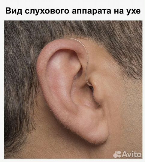 Слуховые аппараты. Вызвать специалиста на дом