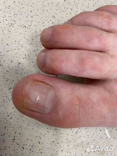 Педикюр пожилым на дому