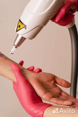 Удаление тату/татуажа лазером