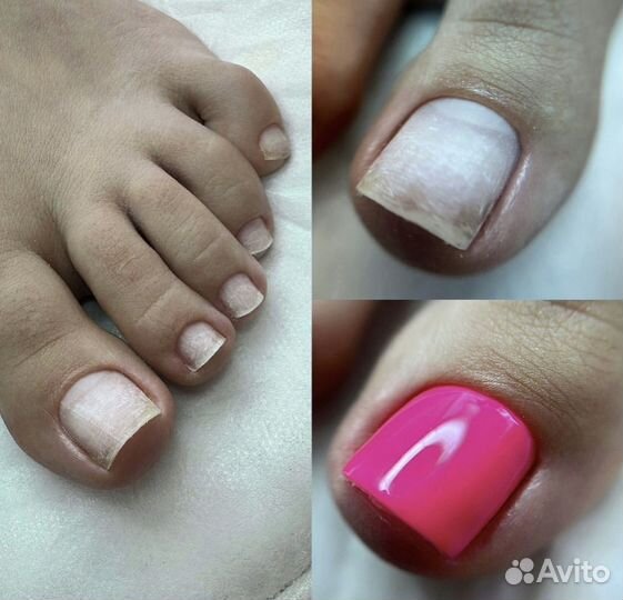 Маникюр, гель-лак, наращивание ногтей, педикюр