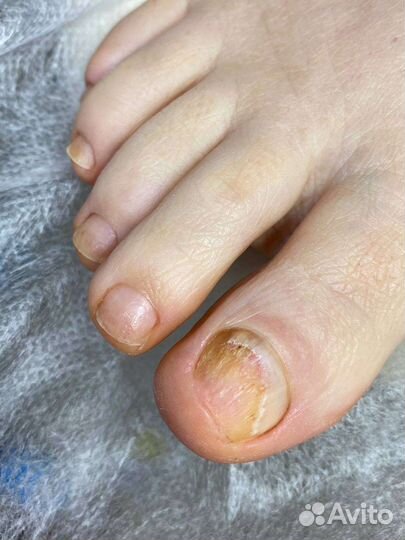 Услуги подолога