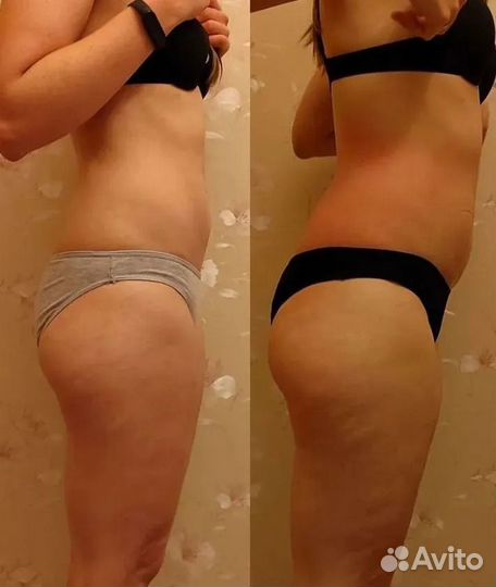 Массажистка