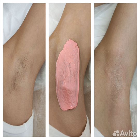 Шугаринг / Восковая Депиляция / Курчатовский район