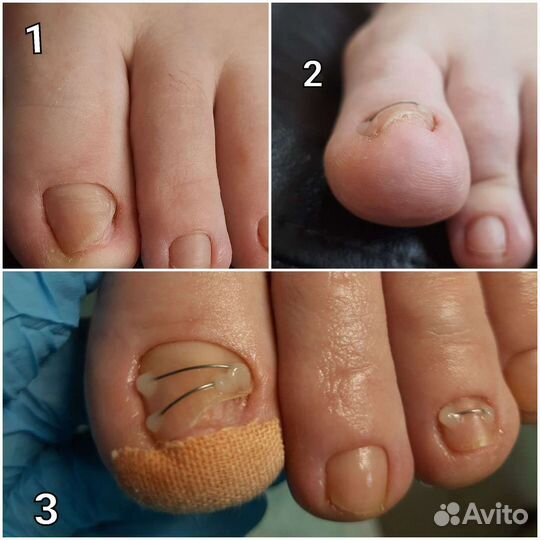 Услуги подолога