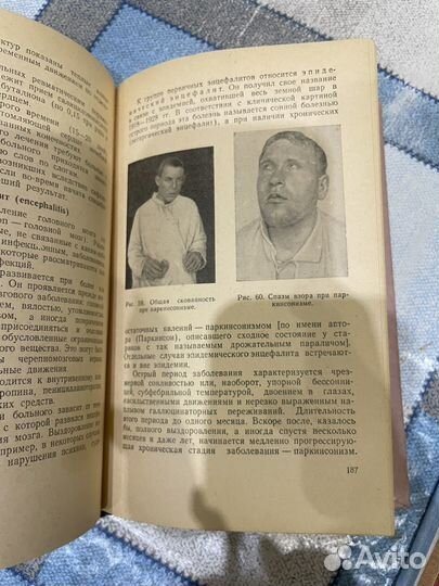 Нервные И психические болезни 1956г